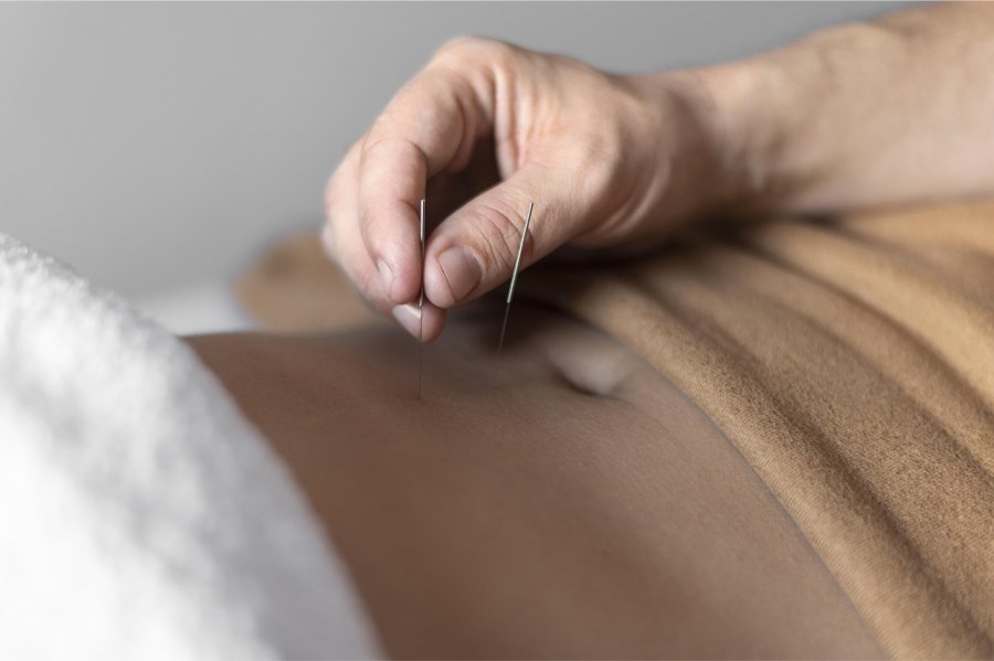 The Importance of Consistency in Acupuncture Treatment